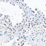 SP1 Antibody in Immunohistochemistry (Paraffin) (IHC (P))