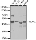 ACAA1 Antibody in Western Blot (WB)