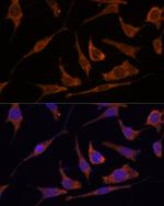 Ribulose-phosphate 3-epimerase Antibody in Immunocytochemistry (ICC/IF)