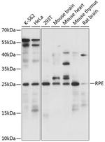 Ribulose-phosphate 3-epimerase Antibody in Western Blot (WB)