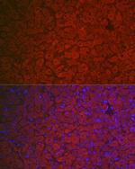 FSHR Antibody in Immunohistochemistry (Paraffin) (IHC (P))