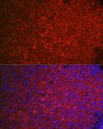 FSHR Antibody in Immunohistochemistry (Paraffin) (IHC (P))