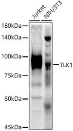 TLK1 Antibody in Western Blot (WB)