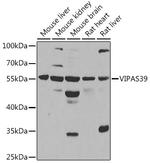 VIPAS39 Antibody in Western Blot (WB)