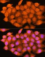 Adenosine Kinase Antibody in Immunocytochemistry (ICC/IF)