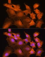 Adenosine Kinase Antibody in Immunocytochemistry (ICC/IF)