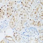 Adenosine Kinase Antibody in Immunohistochemistry (Paraffin) (IHC (P))