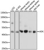 Adenosine Kinase Antibody in Western Blot (WB)