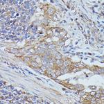 Cortactin Antibody in Immunohistochemistry (Paraffin) (IHC (P))