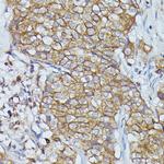 Cortactin Antibody in Immunohistochemistry (Paraffin) (IHC (P))