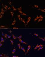 KSR1 Antibody in Immunocytochemistry (ICC/IF)