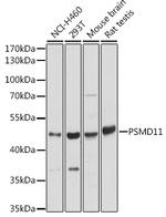 PSMD11 Antibody in Western Blot (WB)