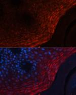 S100A8 Antibody in Immunohistochemistry (Paraffin) (IHC (P))