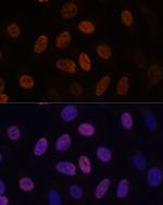 WDHD1 Antibody in Immunocytochemistry (ICC/IF)