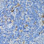 TNFR1 Antibody in Immunohistochemistry (Paraffin) (IHC (P))