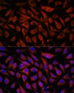 STK38L Antibody in Immunocytochemistry (ICC/IF)