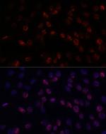 DDX24 Antibody in Immunocytochemistry (ICC/IF)