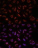 DDX24 Antibody in Immunocytochemistry (ICC/IF)