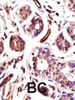 E6AP Antibody in Immunohistochemistry (Paraffin) (IHC (P))