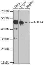 Aurora A Antibody in Western Blot (WB)