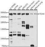 TCHH Antibody in Western Blot (WB)