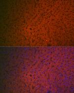 Factor IX Antibody in Immunocytochemistry (ICC/IF)