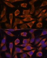 ME3 Antibody in Immunocytochemistry (ICC/IF)