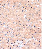 ME3 Antibody in Immunohistochemistry (Paraffin) (IHC (P))