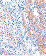 ME3 Antibody in Immunohistochemistry (Paraffin) (IHC (P))