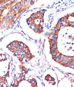 ME3 Antibody in Immunohistochemistry (Paraffin) (IHC (P))