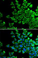 BAD Antibody in Immunocytochemistry (ICC/IF)