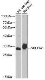 SULT1A1 Antibody in Western Blot (WB)