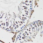 Cyclin B1 Antibody in Immunohistochemistry (Paraffin) (IHC (P))