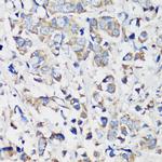 Cyclin B1 Antibody in Immunohistochemistry (Paraffin) (IHC (P))