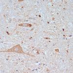 VAChT Antibody in Immunohistochemistry (Paraffin) (IHC (P))