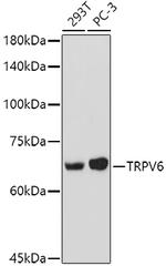 TRPV6 Antibody in Western Blot (WB)