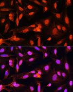 SGOL1 Antibody in Immunocytochemistry (ICC/IF)