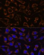 GTPBP8 Antibody in Immunocytochemistry (ICC/IF)