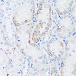 GTPBP8 Antibody in Immunohistochemistry (Paraffin) (IHC (P))