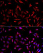 ACSL1 Antibody in Immunocytochemistry (ICC/IF)