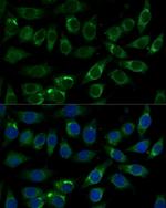 ALDH3A2 Antibody in Immunocytochemistry (ICC/IF)