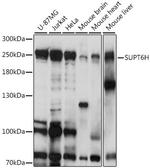SPT6 Antibody in Western Blot (WB)
