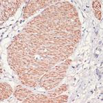 AMPK alpha-1 Antibody in Immunohistochemistry (Paraffin) (IHC (P))