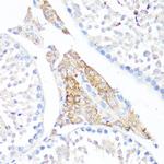 Fibronectin Antibody in Immunohistochemistry (Paraffin) (IHC (P))