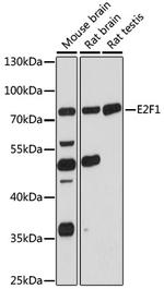 E2F1 Antibody in Western Blot (WB)