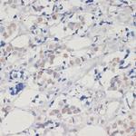 DNMT1 Antibody in Immunohistochemistry (Paraffin) (IHC (P))