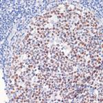 DNMT1 Antibody in Immunohistochemistry (Paraffin) (IHC (P))