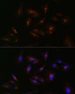 ABCA2 Antibody in Immunocytochemistry (ICC/IF)