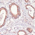 Caspase 3 Antibody in Immunohistochemistry (Paraffin) (IHC (P))