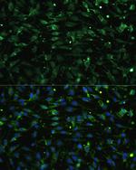 CHRM1 Antibody in Immunocytochemistry (ICC/IF)